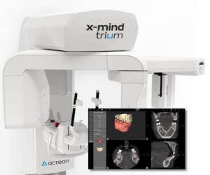 An X-mind trium x ray machine against a white background