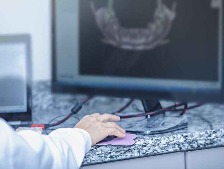 dental equipment for mouth cancer screening: A hand in a white sleeve operates a computer mouse on a granite worktop, in front of a monitor showing a 3D scan of a lower jaw and teeth.